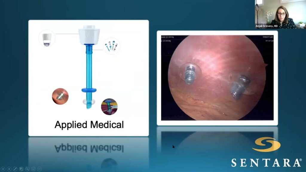 The FELLOW Project Sleeve Gastrectomy Technical Guidelines and Management of Postoperative