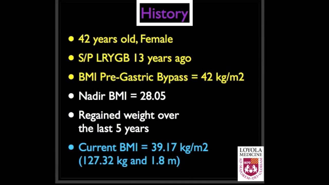 Revision surgery for weight recidivism after laparoscopic rouxeny gastric bypass (lrygb