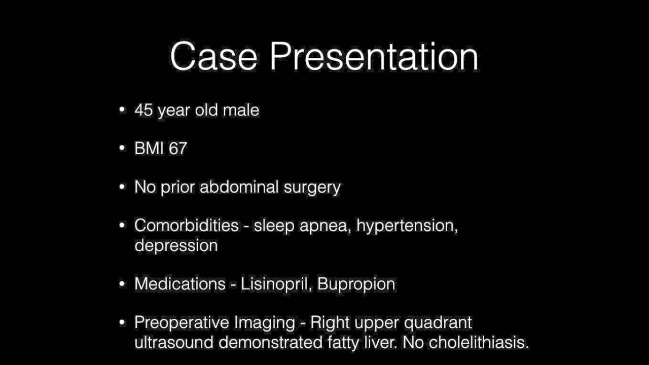 icd 10 code for sp laparoscopic sleeve gastrectomy