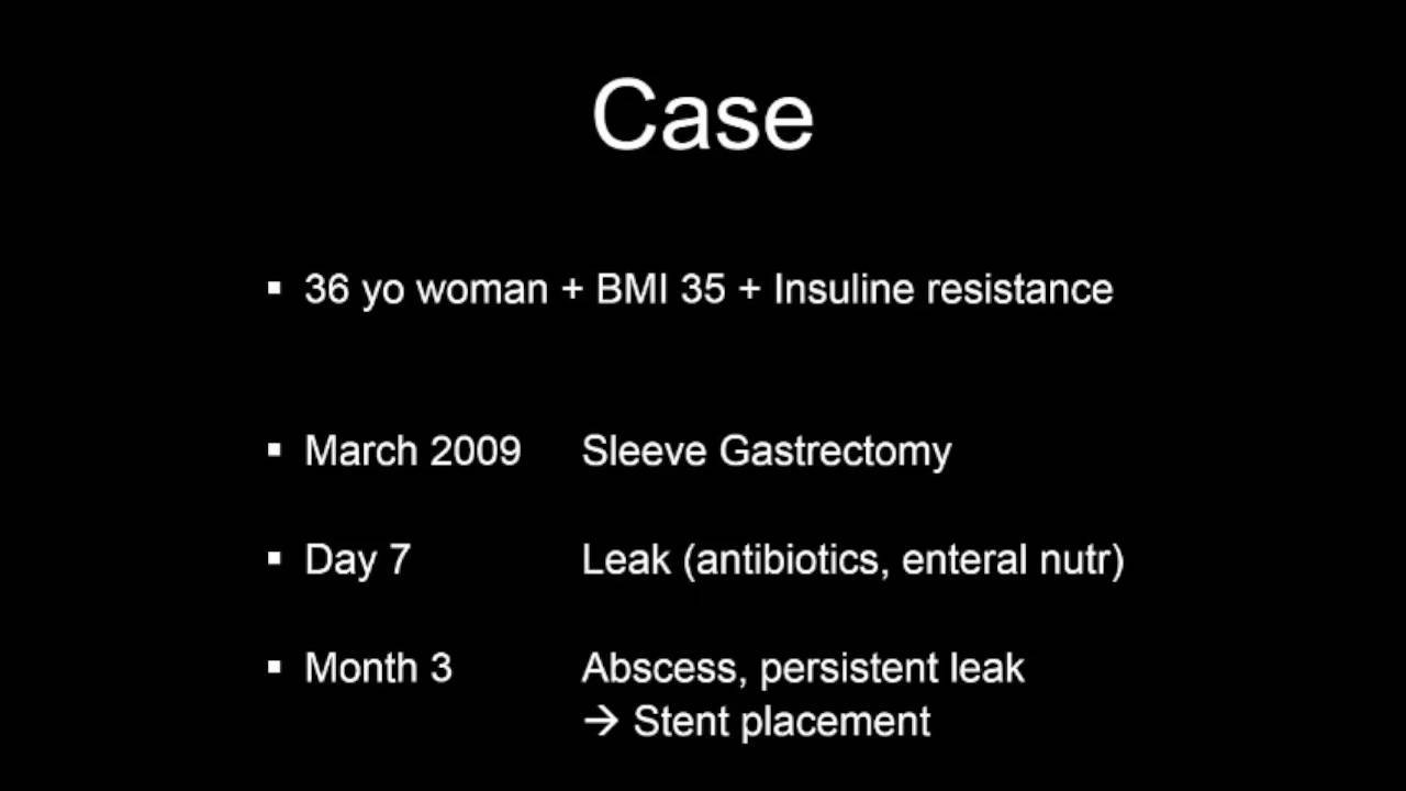 Laparoscopic total gastrectomy for chronic fistula after sleeve
