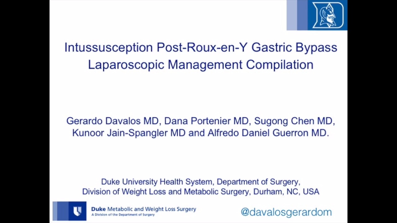 Intussusception Post-Roux-En-Y Gastric Bypass - Laparoscopic Management ...