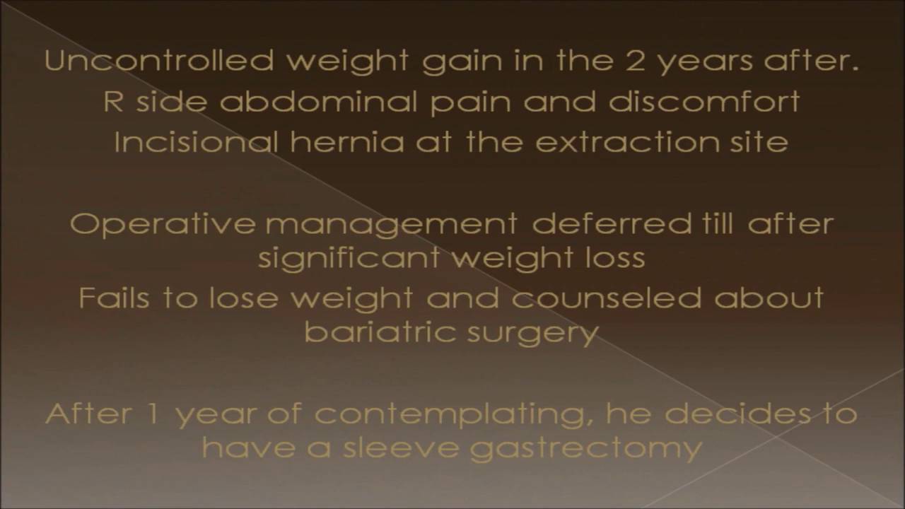 Sleeve gastrectomy, performed through left sided trocars, with repair