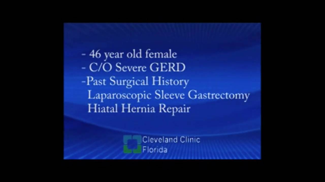 Laparoscopic conversion of laparoscopic sleeve gastrectomy (lsg) to ...