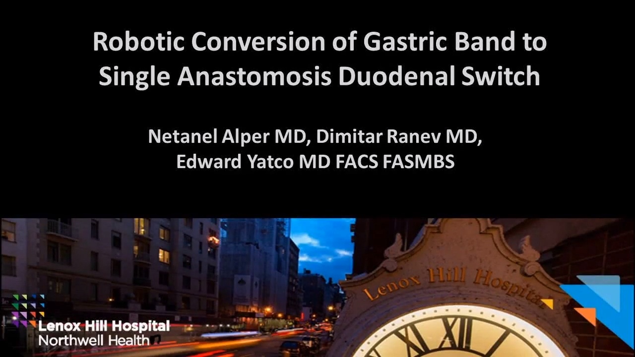 Robotic Conversion of Gastric Band to Single Anastomosis Duodenal