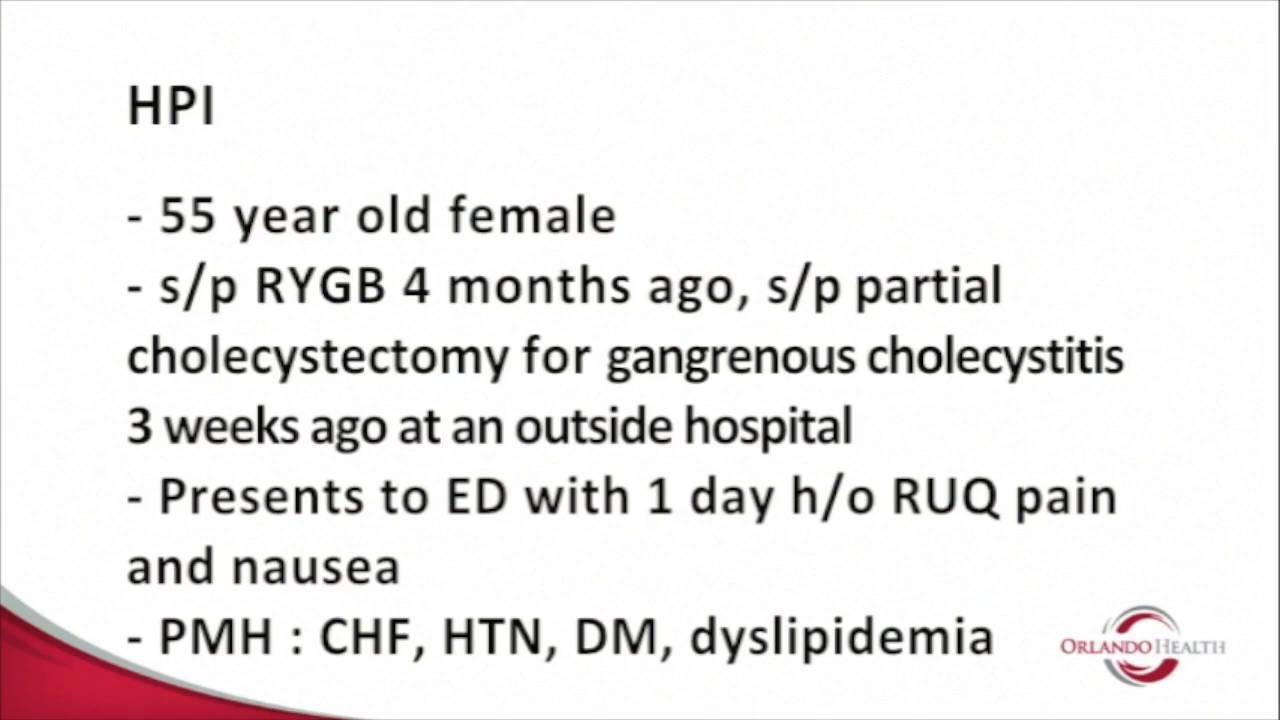 Afferent limb obstruction at the ligament of treitz due to gallstone ...